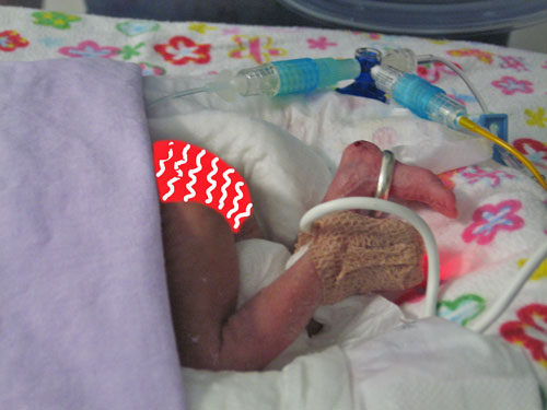 This image has been digitally enhanced. But I only added the frilly pants. Check out Anthony's wedding band on her foot. Could have just as easily been a garter.